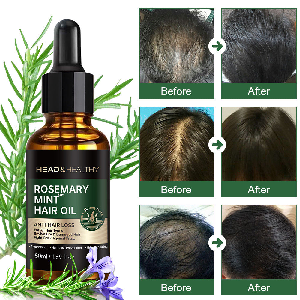 Scalp Essential Oil Hair Care Essence Nourishing Treatment